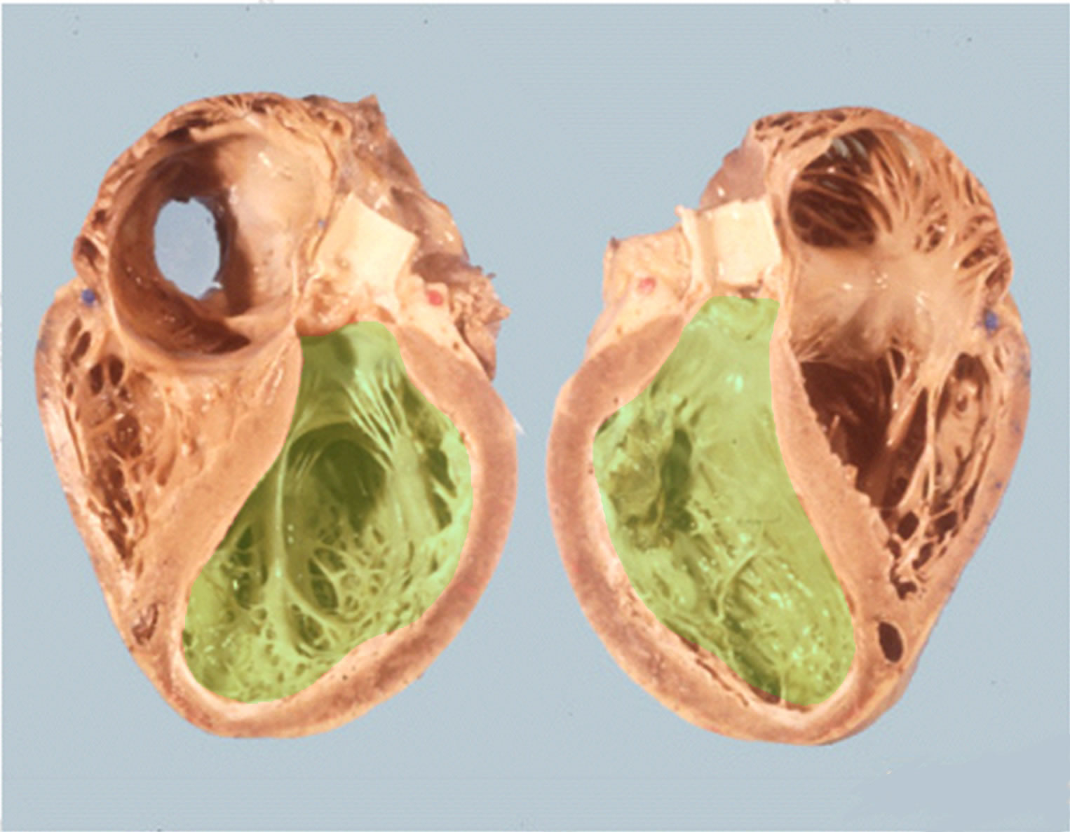 Pathologie