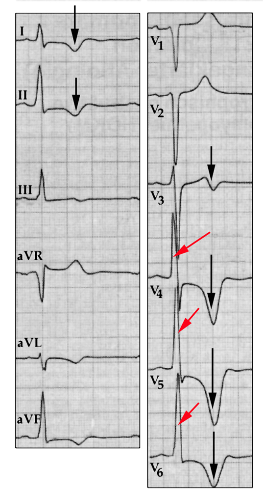 Elektrik des Herzens
