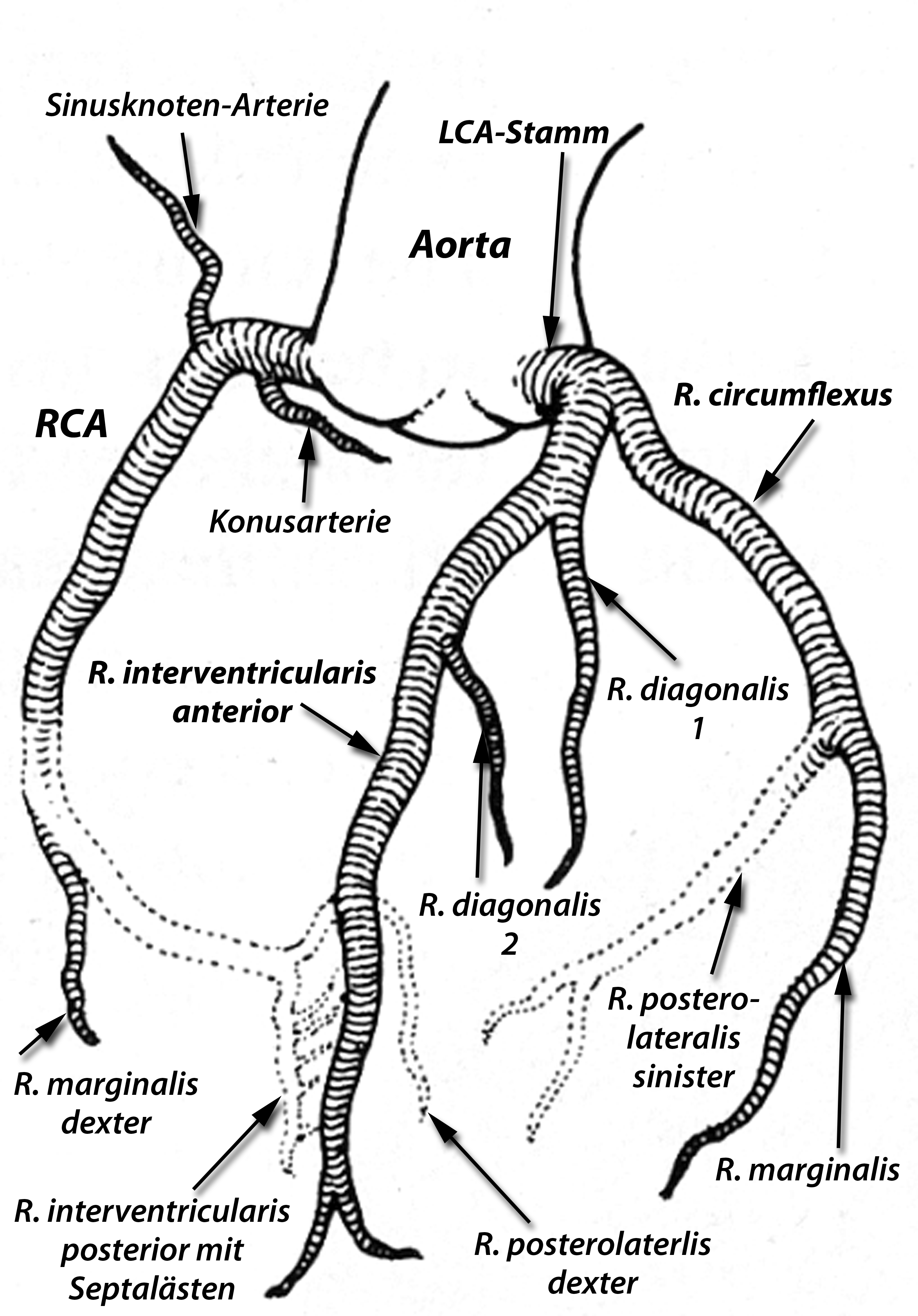 Koronarschema