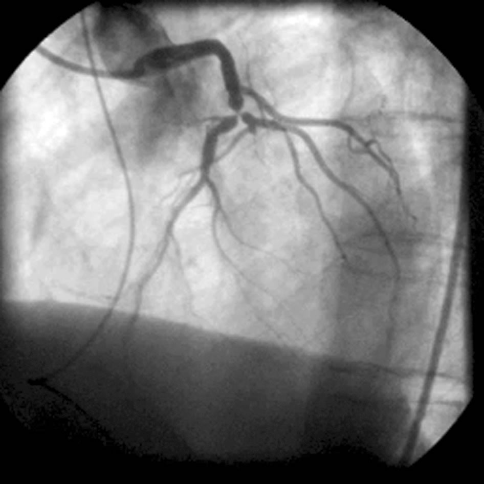 Thumbnail Image 1