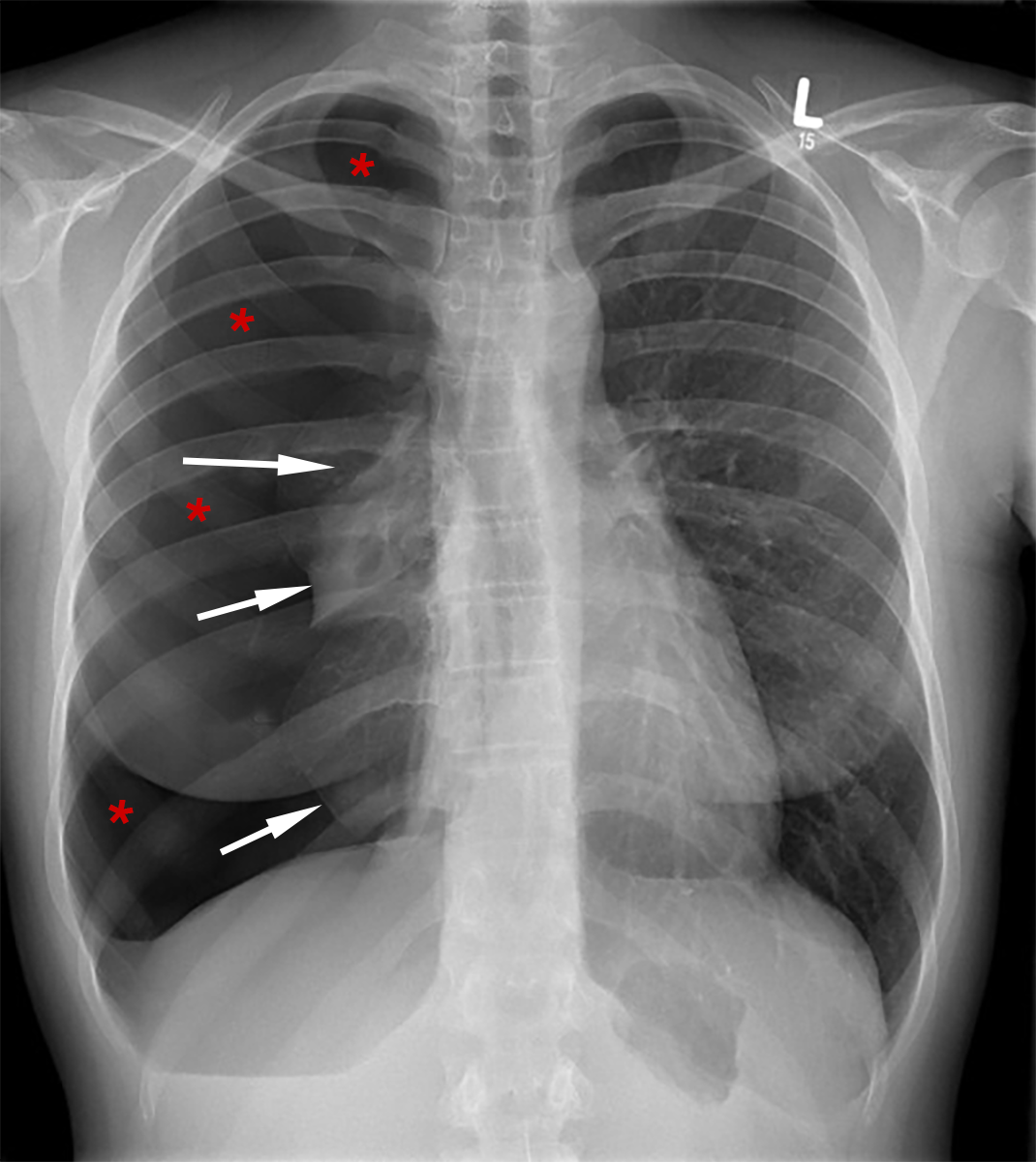 Elektrik des Herzens