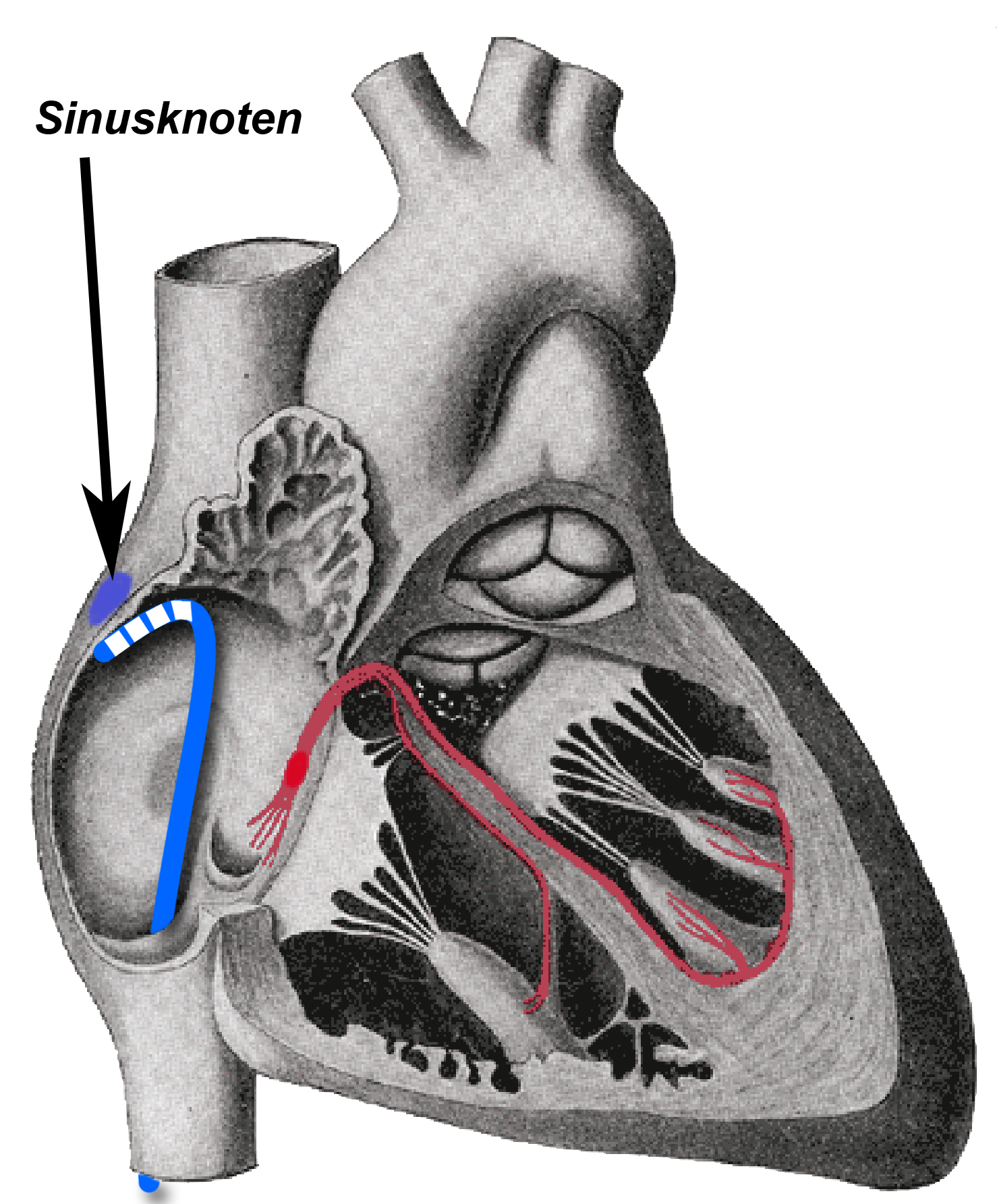 Sinusknotenerholungszeit