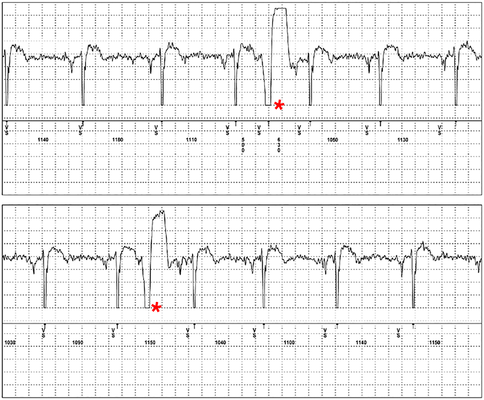 Elektrik des Herzens