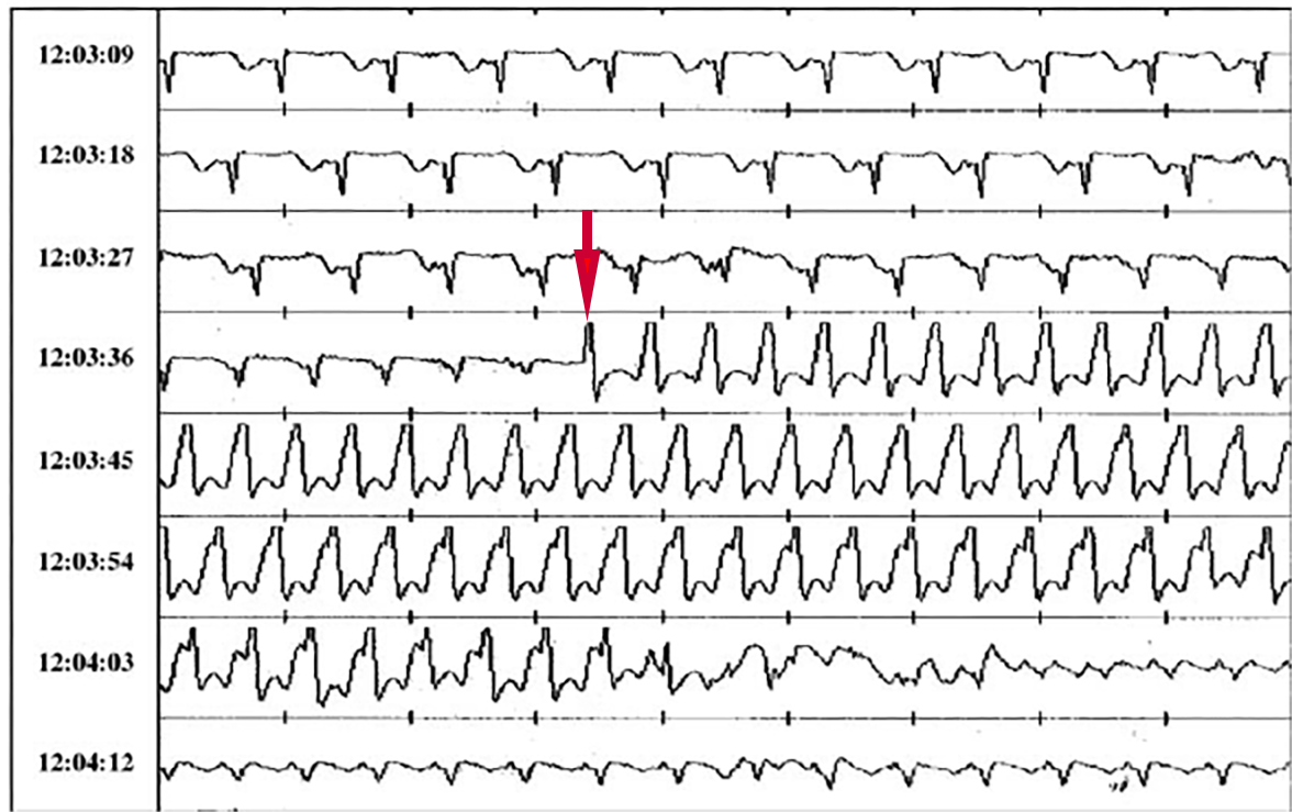 Elektrik des Herzens